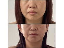 ポラス(Polus)の雰囲気（《小顔コルギ》左右差・歪み・むくみ・輪郭変化は当店へ）