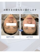 ヴィアージュ(Viage)/