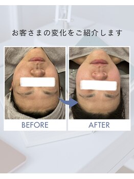 ヴィアージュ(Viage)/