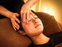 美容鍼灸サロン respirer 麻布十番【美容鍼・ほうれい線改善・肩こり眼精疲労】の雰囲気（美容鍼×頭皮鍼でリフトアップ。）