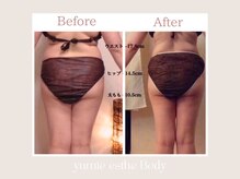 トータルビューティー ゆみえエステ(Total Beauty)の雰囲気（全身スッキリ！痩身&ボディメイクお任せください◎）