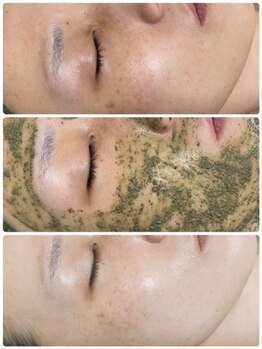 ココピュアレ(coco purele)/REVIハーブピーリング☆