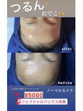 ロア(ROA)/フェイシャルワックス