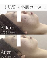 ボディベルム(BODY BELM)/お肌のケアもお任せください