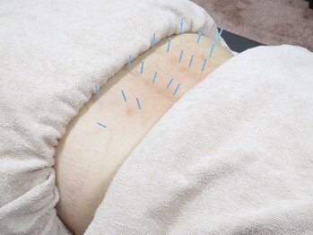 リンク 広島中区(Link)/施術風景