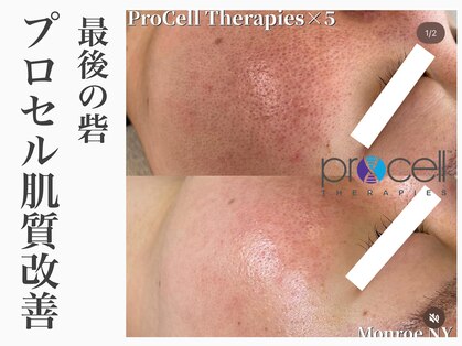 レイ(Rey)の写真