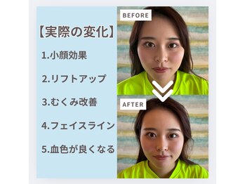 ハウオラ 三軒茶屋(HAUOLA)/ビフォーアフター