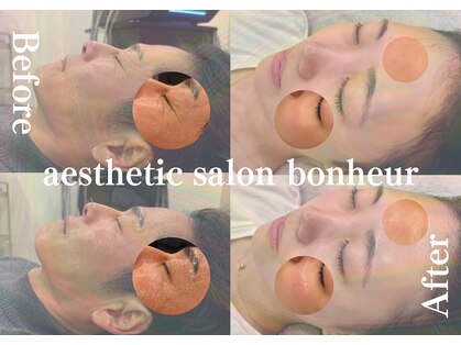 ボヌール(bonheur)の写真