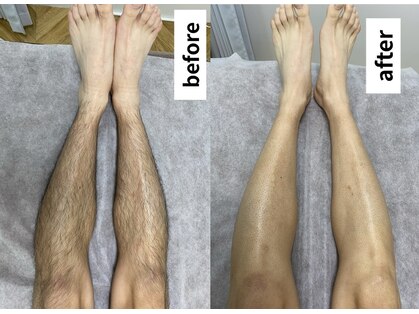 ゼロミリメートル(0mm)の写真