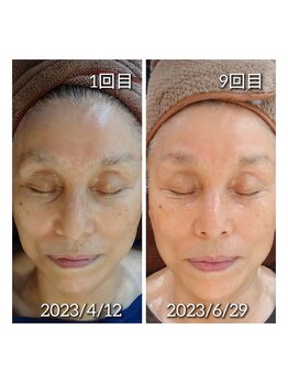 ミューク 自由が丘(mjuk)/細胞活性化セルラムフェイシャル