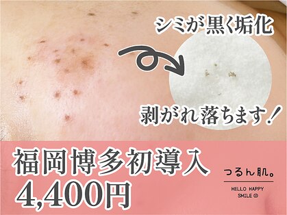 つるん肌。 福岡博多筑紫口店の写真