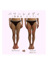 ルア(LuA.)/パワーレメディ◎