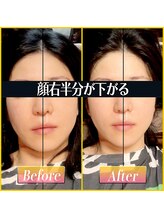 てんてんてんまてん/小顔矯正/骨盤矯正/整体/肩こり