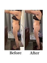 ハリムーン 仙台(harimoon)/バストに大切な肋骨ケア