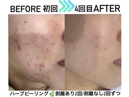 リンフェイス 横浜店(RINFACE)の写真