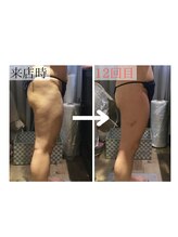 アンジュ(Ange)/セルゼロでスタイルアップ★