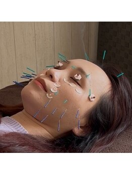 彩花/鍼の本数にこだわり、結果重視