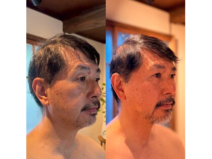 ハリドコロケン(KEN)の写真
