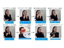 ホワイトニングショップ 尾道店(WHITENING SHOP)の雰囲気（タバコやコーヒー、ワインなどの着色などもホワイトニング♪）