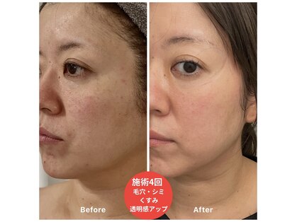 フワリ(fuwari)の写真