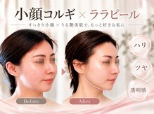 アミュ ル ブラン ナゴヤ(AMU Le blanc NAGOYA)