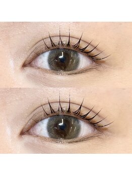 ラルム(Larme)/◇施術イメージ◇