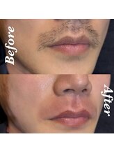 レイジュ(RayJU)/