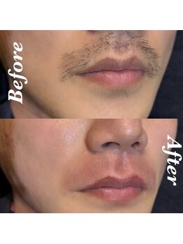 レイジュ(RayJU)/