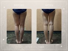 アバンダンティア 姫路店/太もものすきま、作れます！