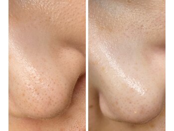 サイ(Sai)/before⇒after