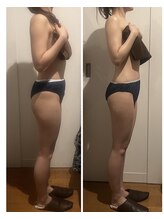 バンブー B2 新涯店(Bamboo)/人気No.1キャビリンパ!1回施術