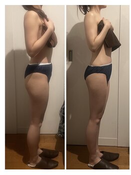 バンブー B2 新涯店(Bamboo)/人気No.1キャビリンパ!1回施術