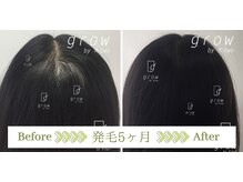 頭皮ケア専門サロン グロウ(grow by k-two)