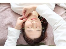 インヤン(yinyang)/美容鍼施術