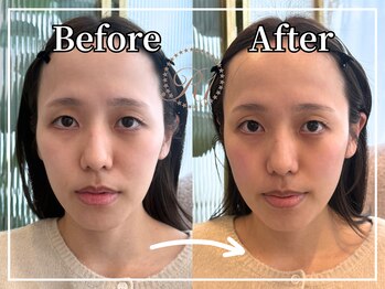 R-1ビューティーサロン 銀座/Before&After