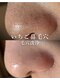 シェリー(Cherie)の写真/頑固な黒ずみ・ひらき毛穴・角栓つまりを解消！毛穴洗浄でいちご鼻もスッキリ◎透明感あふれる素肌へ！