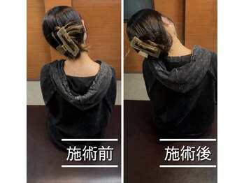 ファミリア整体院の写真/【首・肩こりの症状を改善！】首、肩こり、肩甲骨はがし専門整体！！初回￥3500