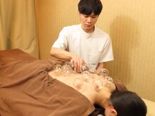 ビファイン鍼灸治療院 代々木上原院/カッピング施術