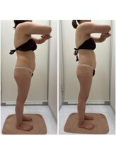 リッツ ひばりが丘パルコ店/【Before/After】痩身