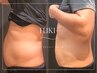 メンズ初回体験【ボディ人気No.1☆】脂肪燃焼剤5ml導入×痩身マッサージ