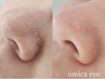 ウミカ(umica)/パーツWAX☆鼻