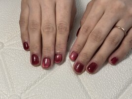 マグネット施術写真