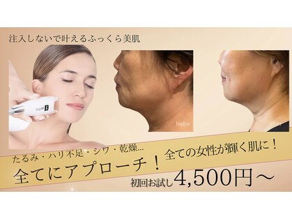 ビューティーマックス エースタジオ(Beauty MAX Astudio)の写真