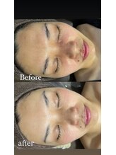 エクラ(ECLAT)/レストセルトリートメント