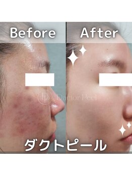 セカンドフロア バイ ブレスト ハコダテ(2nd floor by BLESSED HKD)/再生持続型ダクトピール