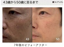 ワンモア(ONEMORE)/