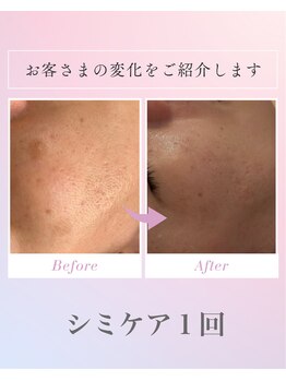 ヴィアージュ(Viage)/