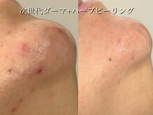 ライリー(Rairy)