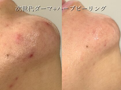 ライリー(Rairy)の写真