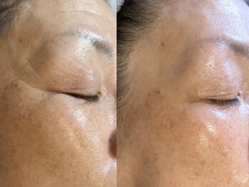 ラレンヌ/ララピール